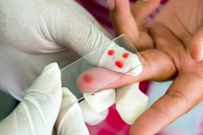Diagnosis of pain in the fingers joints